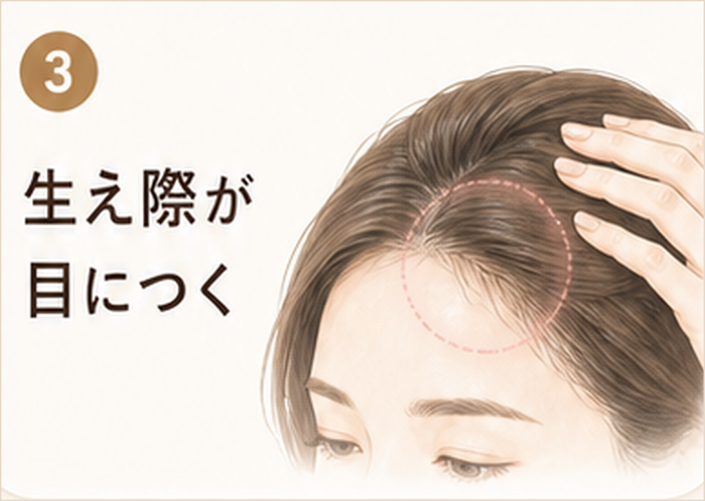 生え際が目につく
